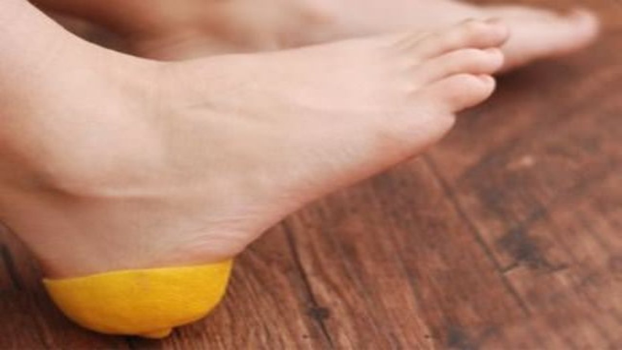 Topuk çatlaklarından kurtaran limonlu çözüm! Bir deneyin işe yarıyor